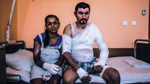 Donka and Georgi Kostov in the burn-victim unit of St. George hospital in Plovdiv, two weeks after Georgi's suicide attempt; Photo by Jackson Fager